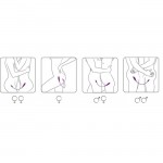 Adrien Lastic 2 Double Ended Vibrator